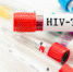 Sample blood collection tube with HIV test label on HIV infection screening test form. - Вечер Елабуги